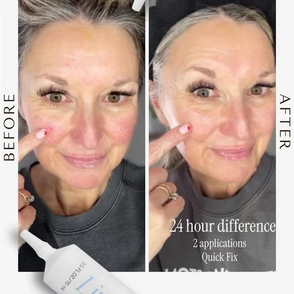 Quick fix - Picture 8 of 12